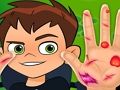 Joc Metge de mà Ben10  en línia