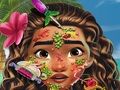 Joc Moana Skin Doctor en lĂnia Joc Moana Skin Doctor en lĂnia