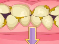 Joc Bad Teeth Makeover en línia