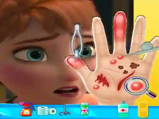 Joc Anna hand doctor en línia