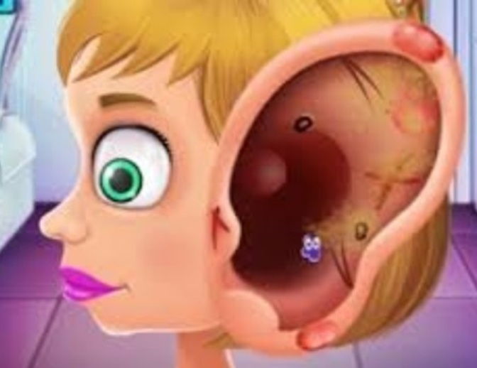 Joc Doctor infantil que tracta les orelles  en línia